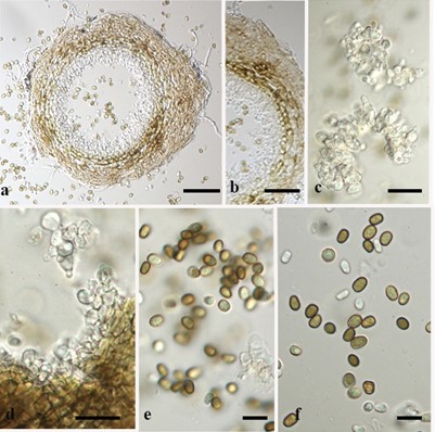 Austropleospora - Fungalpedia